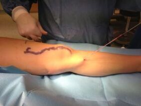 cirurgia